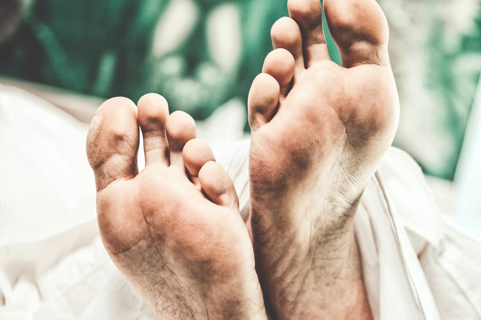 Burning Feet: Neuropathy, Athlete's Foot, or the Shoe